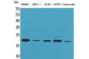 Western Blotting (WB) image for anti-Fibroblast Growth Factor 20 (FGF20) (Internal Region) antibody (ABIN3178209) (FGF20 anticorps  (Internal Region))