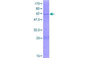 Image no. 1 for 3-hydroxyisobutyrate Dehydrogenase (HIBADH) (AA 1-336) protein (GST tag) (ABIN1306610)