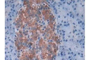 Detection of SNX13 in Human Pancreas Tissue using Polyclonal Antibody to Sorting Nexin 13 (SNX13)