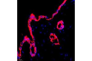 Immunofluorescent analysis of paraffin embedded mouse skin using CK6 (ABIN7074423) at dilution of 1: 2000 (Keratin 6 anticorps)