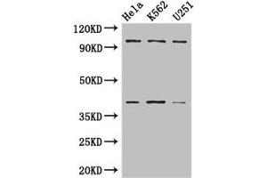 Western Blot Positive WB detected in: Hela whole cell lysate, K562 whole cell lysate, U251 whole cell lysate All lanes: PSMD2 antibody at 3 μg/mL Secondary Goat polyclonal to rabbit IgG at 1/50000 dilution Predicted band size: 101, 83, 86 kDa Observed band size: 101, 40 kDa (PSMD2 anticorps  (Regulatory Subunit 2))