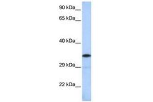 Image no. 1 for anti-BTB (POZ) Domain-Containing Protein KCTD4 (KCTD4) (AA 144-193) antibody (ABIN6742587) (KCTD4 anticorps  (AA 144-193))