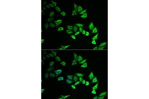 Immunofluorescence analysis of U2OS cell using MYOZ2 antibody. (MYOZ2 anticorps)