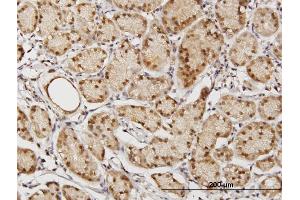 Immunoperoxidase of purified MaxPab antibody to TSNAXIP1 on formalin-fixed paraffin-embedded human stomach.