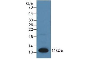 Detection of Recombinant S100, Human using Polyclonal Antibody to S100 Calcium Binding Protein (S100) (S100 Protein (S100) (AA 1-94) anticorps)
