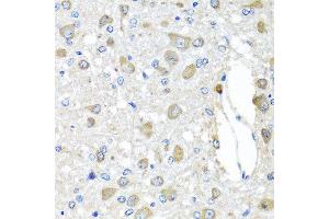 Immunohistochemistry of paraffin-embedded rat brain using BAG5 antibody at dilution of 1:100 (x40 lens). (BAG5 anticorps)