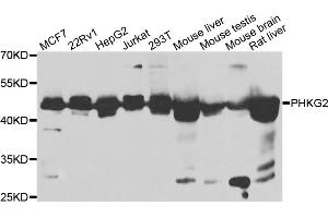 Western blot analysis of extracts of various cell lines, using PHKG2 antibody (ABIN5975111) at 1/1000 dilution. (PHKG2 anticorps)