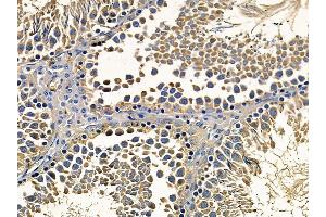 anti-Bromodomain PHD Finger Transcription Factor (BPTF) antibody
