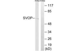 Western blot analysis of extracts from K562 cells, using SVOP antibody. (SVOP anticorps)
