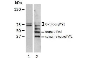 Western blot analysis of total cell lysate (200 µg) from serum stimulated bovine endothelial cells (lane 1) and HeLa cells (lane 2) probed with chicken anti-human YY1 antibody. (YY1 anticorps  (full length))