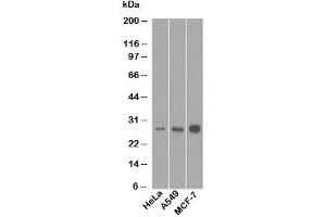 Western blot testing of human samples with Bcl-2 antibody (8C8). (Bcl-2 anticorps  (AA 41-54))