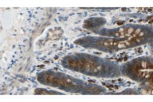 ABIN6274427 at 1/100 staining Mouse intestine tissue by IHC-P. (CAMKV anticorps  (Internal Region))