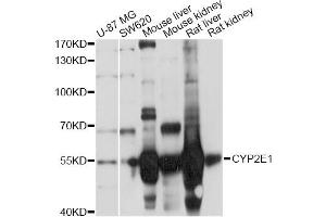 Western blot analysis of extracts of various cell lines, using CYP2E1 Antibody (ABIN5971187) at 1/1000 dilution. (CYP2E1 anticorps)