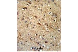 RGR Antibody (Center) (ABIN653851 and ABIN2843113) IHC analysis in formalin fixed and paraffin embedded brain tissue followed by peroxidase conjugation of the secondary antibody and DAB staining. (RGR anticorps  (AA 265-291))