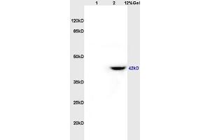 Lane 1: rat brain lysates Lane 2: rat heart lysates probed with Anti CD84/SLAMF5 Polyclonal Antibody, Unconjugated (ABIN741465) at 1:200 in 4 °C. (CD84 anticorps  (AA 231-329))