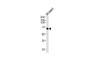 Western blot analysis of lysate from mouse heart tissue lysate, using Mouse Mapkapk3 Antibody at 1:1000 at each lane.