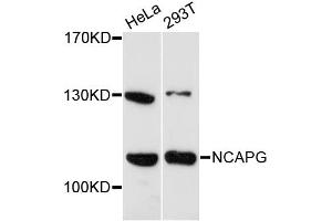 Western blot analysis of extracts of various cell lines, using NCAPG antibody (ABIN6291952) at 1:3000 dilution.