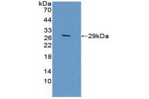 Detection of Recombinant TFR2, Mouse using Polyclonal Antibody to Transferrin Receptor 2 (TFR2) (Transferrin Receptor 2 anticorps  (AA 86-259))