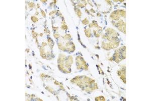 Immunohistochemistry of paraffin-embedded human stomach using MLN antibody (ABIN5973790) at dilution of 1/100 (40x lens). (Motilin anticorps)