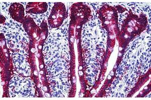 Human Intestine: Formalin-Fixed, Paraffin-Embedded (FFPE) (EpCAM anticorps)