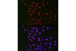 Immunofluorescence analysis of C6 cells using GPS1 Rabbit pAb (ABIN6127934, ABIN6141361, ABIN6141362 and ABIN6222653) at dilution of 1:100 (40x lens).