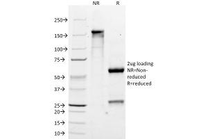 SDS-PAGE Analysis Purified MART-1 Monoclonal Antibody (M2-7C10).
