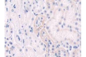 DAB staining on IHC-P; Samples: Rat Kidney Tissue (IDO anticorps  (AA 106-190))