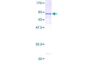 Image no. 1 for RecQ Protein-Like 5 (RECQL5) (AA 1-435) protein (GST tag) (ABIN1317754)