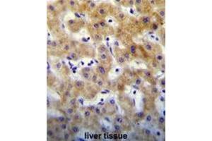 KTAP2 Antibody (C-term) immunohistochemistry analysis in formalin fixed and paraffin embedded human liver tissue followed by peroxidase conjugation of the secondary antibody and DAB staining. (KRTCAP2 anticorps  (C-Term))