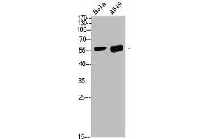 Western blot analysis of HELA A549 Cell Lysate, antibody was diluted at 1:1000. (DCT anticorps  (AA 1268-1341))