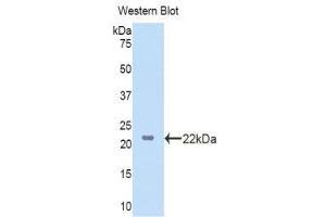 Western Blotting (WB) image for anti-Lanosterol Synthase (2,3-Oxidosqualene-Lanosterol Cyclase) (LSS) (AA 388-549) antibody (ABIN1860102) (LSS anticorps  (AA 388-549))