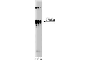 Western Blotting (WB) image for anti-Protein Kinase C, delta (PKCd) (AA 114-289) antibody (ABIN967943)