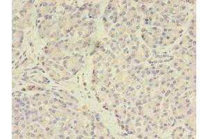 Immunohistochemistry of paraffin-embedded human pancreatic tissue using ABIN7159505 at dilution of 1:100 (STEAP3 anticorps  (AA 1-207))