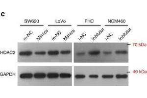 miR-500a-5p suppresses cell proliferation and invasion by targeting HDAC2 in vitro. (HDAC2 anticorps  (C-Term))