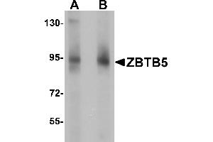 Western Blotting (WB) image for anti-Zinc Finger and BTB Domain Containing 5 (ZBTB5) (C-Term) antibody (ABIN1030813) (ZBTB5 anticorps  (C-Term))