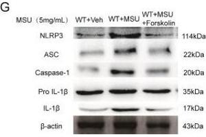 Upregulated cAMP suppressed acute gouty arthritis in vivo.