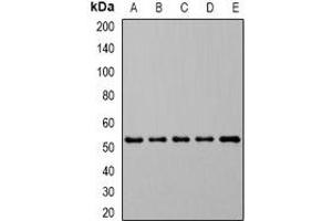 Western blot analysis of DHODH expression in MCF7 (A), HL60 (B), SW620 (C), mouse spleen (D), rat kidney (E) whole cell lysates. (DHODH anticorps)