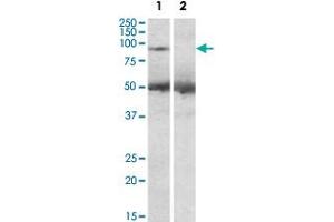 USP6 polyclonal antibody (2 ug/mL) staining of human placenta lysate (35 ug protein in RIPA buffer) with (lane 2) and without (lane 1) blocking with the immunizing peptide. (USP6 anticorps  (C-Term))