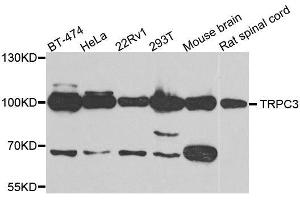 Western blot analysis of extracts of various cell lines, using TRPC3 antibody. (TRPC3 anticorps)