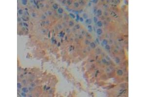 Figure. (Mucosae Associated Epithelia Chemokine (AA 17-130) anticorps)