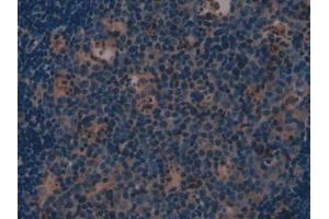 IHC-P analysis of Mouse Lymph node Tissue, with DAB staining. (Involucrin anticorps  (AA 301-460))