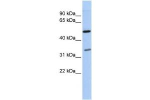 Western Blotting (WB) image for anti-Polyglutamine Binding Protein 1 (PQBP1) antibody (ABIN2457939)