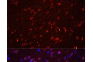 Immunofluorescence analysis of Rat brain using GRIN2B Polyclonal Antibody at dilution of 1:100. (GRIN2B anticorps)