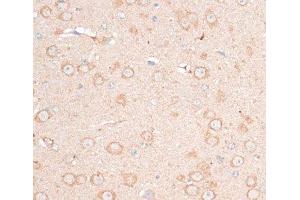 Immunohistochemistry of paraffin-embedded Mouse brain using CDH18 Polyclonal Antibody at dilution of 1:100 (40x lens).
