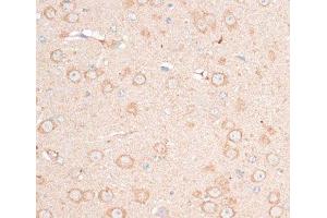 Immunohistochemistry of paraffin-embedded Mouse brain using CDH18 Polyclonal Antibody at dilution of 1:100 (40x lens). (CDH18 anticorps)