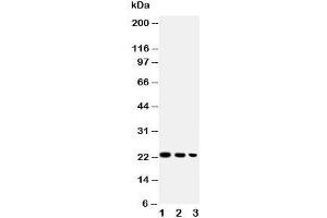 Western blot testing of BAFF antibody and Lane 1:  recombinant human protein 10ng;  2: 5ng;  3: 2. (BAFF anticorps  (AA 265-285))
