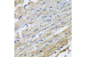 Immunohistochemistry of paraffin-embedded rat heart using SNAP29 antibody.