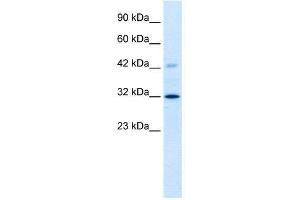 WB Suggested Anti-VDAC1  Antibody Titration: 1. (VDAC1 anticorps  (C-Term))