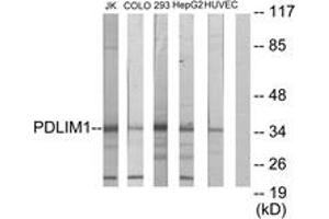 Western blot analysis of extracts from Jurkat/COLO205/293/HepG2/HuvEc cells, using PDLIM1 Antibody. (PDLIM1 anticorps  (AA 61-110))