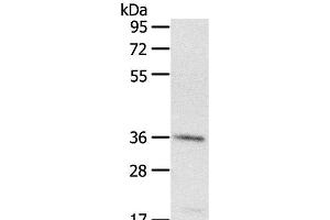 Western Blot analysis of A431 cell using PDLIM4 Polyclonal Antibody at dilution of 1:400 (PDLIM4 anticorps)